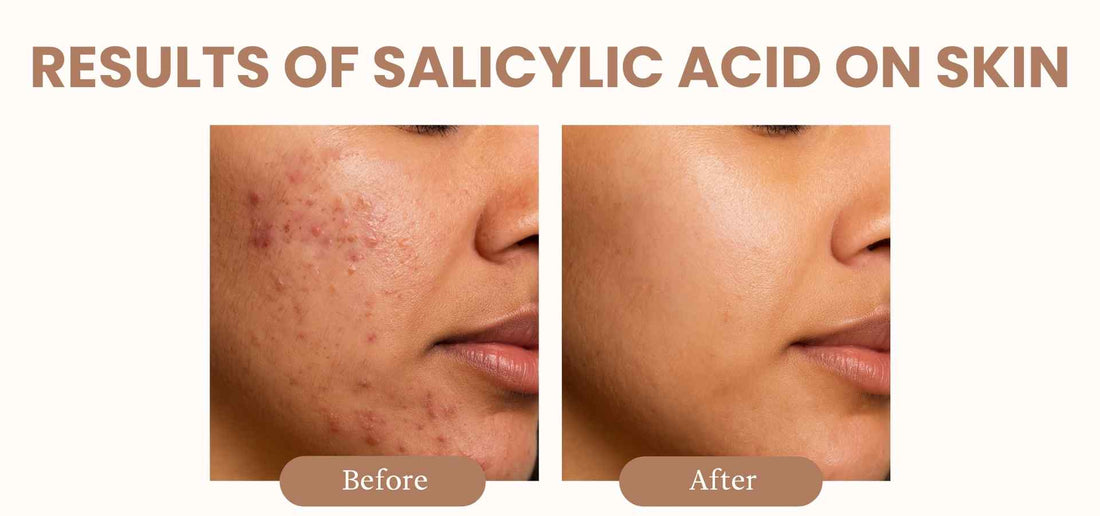 slider image slider_item_kFXVer